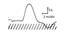Motor response recording
