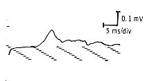 Motor response waveform characteristics