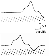 Conduction velocity calculation