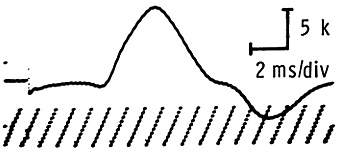 Defective recording electrode demonstration
