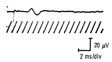 Electrode positioning relative to muscle motor points