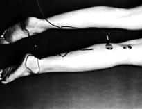 H-reflex response pattern