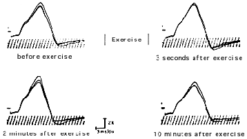 Pre and post-exercise response patterns