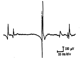 Motor unit structure