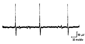 Motor units during mild effort