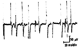 Motor unit recruitment during moderate effort