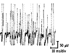 Full effort interference pattern