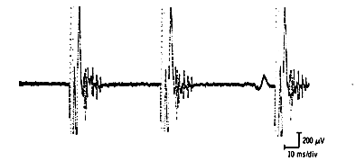 Polyphasic nascent potentials