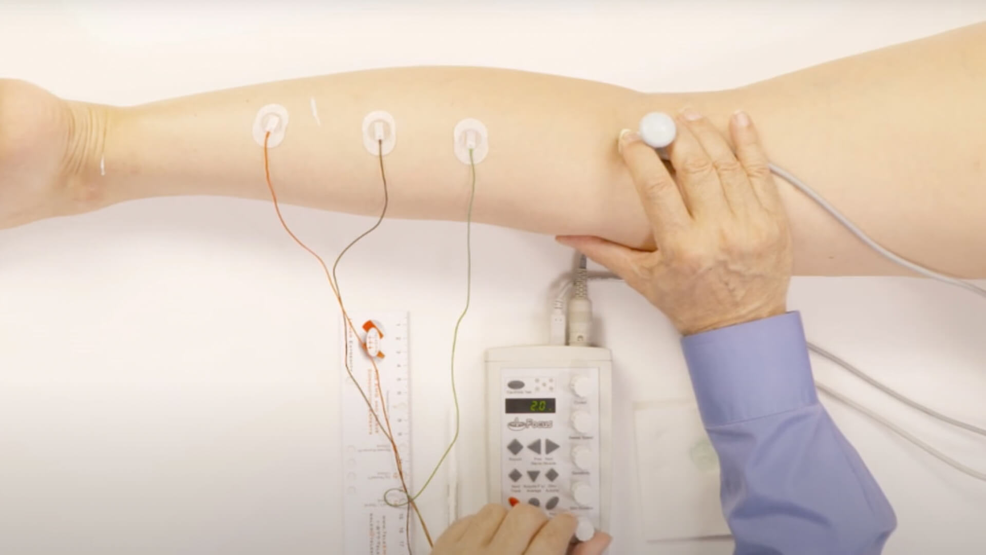 NCV Exam - Tibial H-Reflex