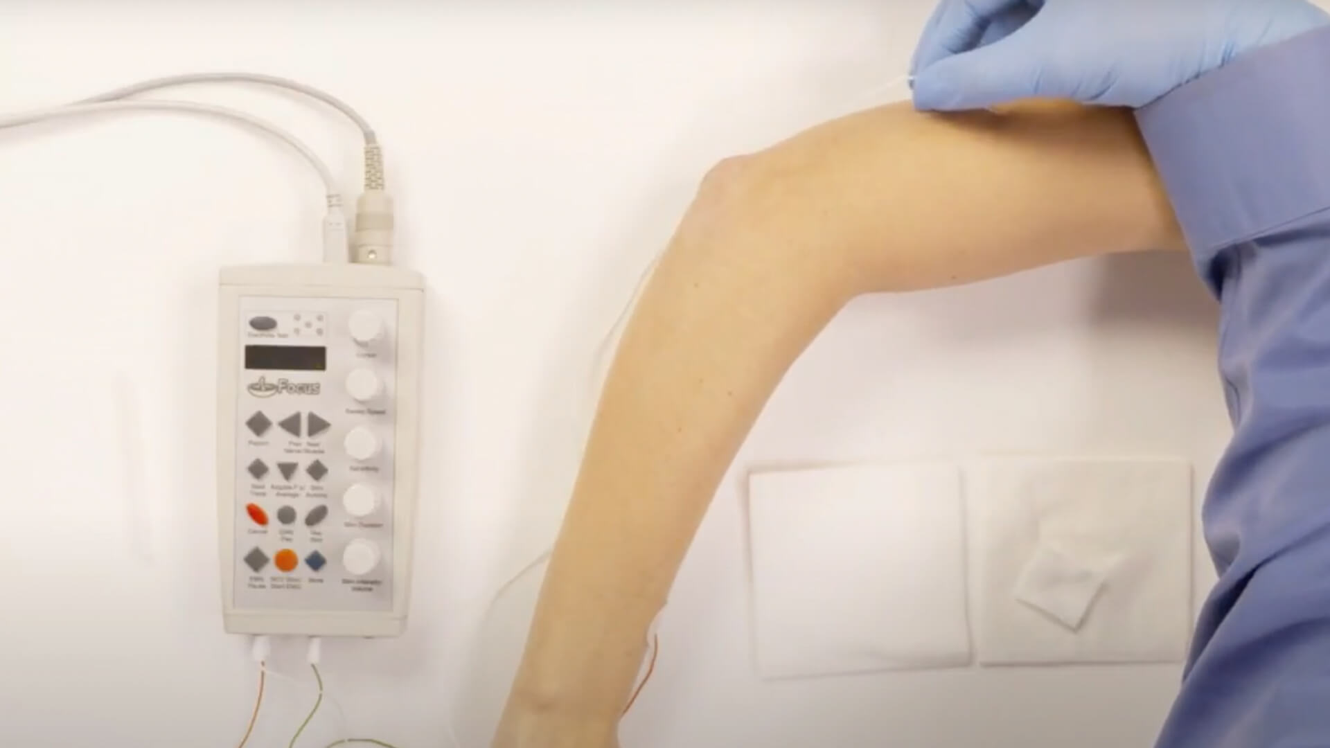 EMG Needle Exam - Triceps (TRI)