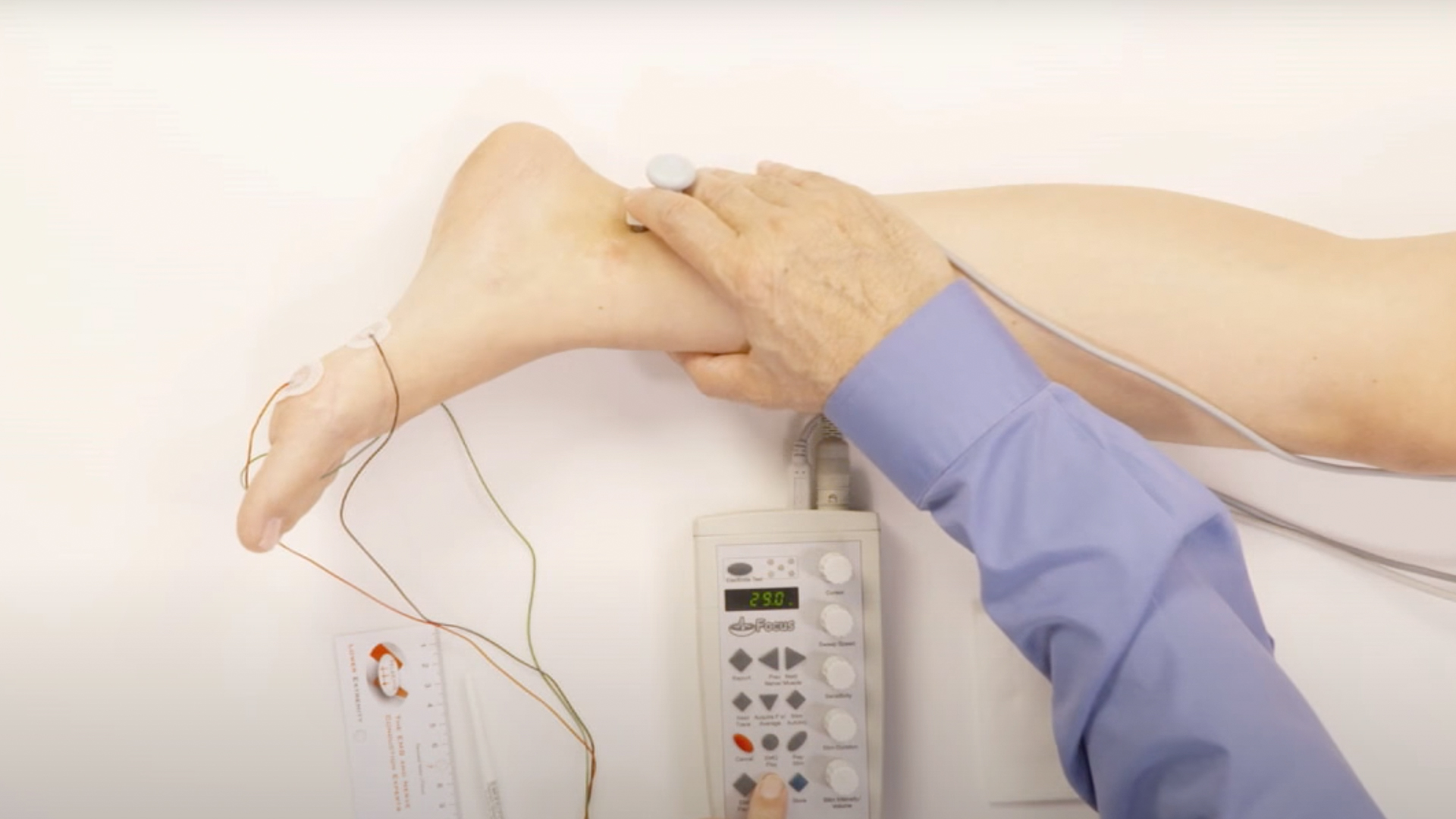 NCV Exam - Tibial Motor with F-wave